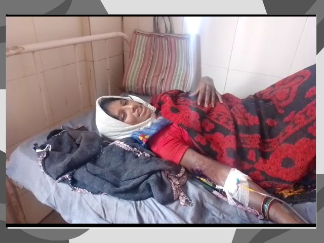 घरेलू गैस की पाइप लीकेज से लगी आग झुलसी महिला
